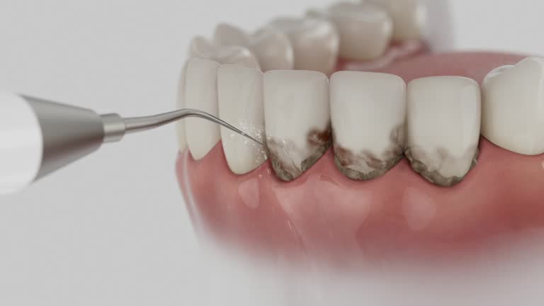Trusted Root Canal Treatment service in Chatham, VA - Dentist Open Now